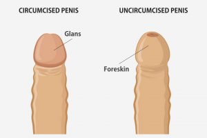 Circumcision & Non Circumcision